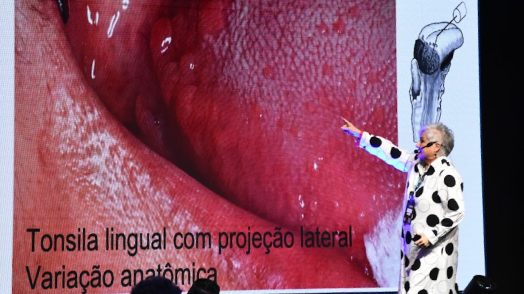 First slide